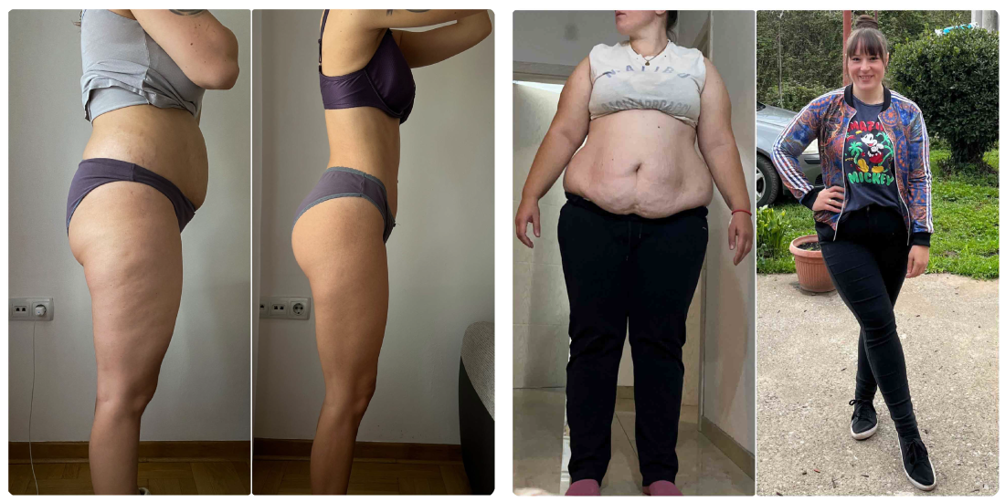 celo telo nikola orozovic